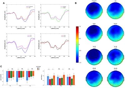 Altered auditory processes pattern predicts cognitive decline in older adults: different modalities with aging